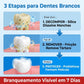 Compre 1 Leve 2] Kit de 2 Unidades Pasta de Dentes colugea™ SP-4 Branqueadora (2x100g)